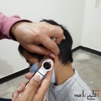 شنوایی سنجی