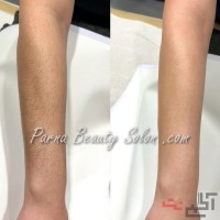 سالن اپیلاسیون کل بدن