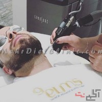 لیزر مو های زائد غرب تهران