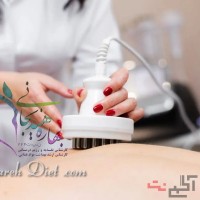 لاغری، فرم دهی و لیفت پوست با دستگاه RF