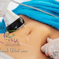 هزینه لاغری با دستگاه آر اف