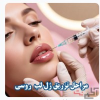 خدمات تخصصی زیبایی با فیلر و ژل؛ کانتورینگ صورت، ژل لب روسی و فیلر بیکینی