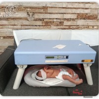 اجاره دستگاه زردی نوزاد در منزل؛ راهکاری آسان برای مراقبت از نوزاد تحت نظر پزشک