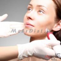 دستگاه لاغری فرکشنال آر اف Fractional RF