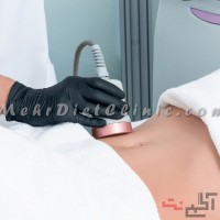 کلینیک لاغری با دستگاه شمال تهران